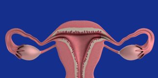 endometrioza
