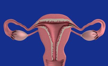 Endometrioza – co powinnaś o niej wiedzieć? endometrioza